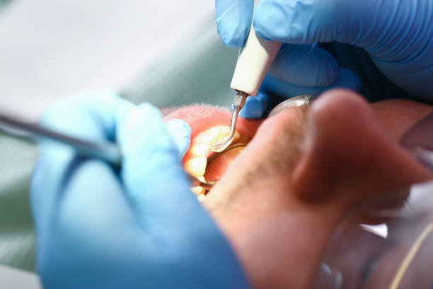 Best Mobile Emergency Dentist in Durham, NC